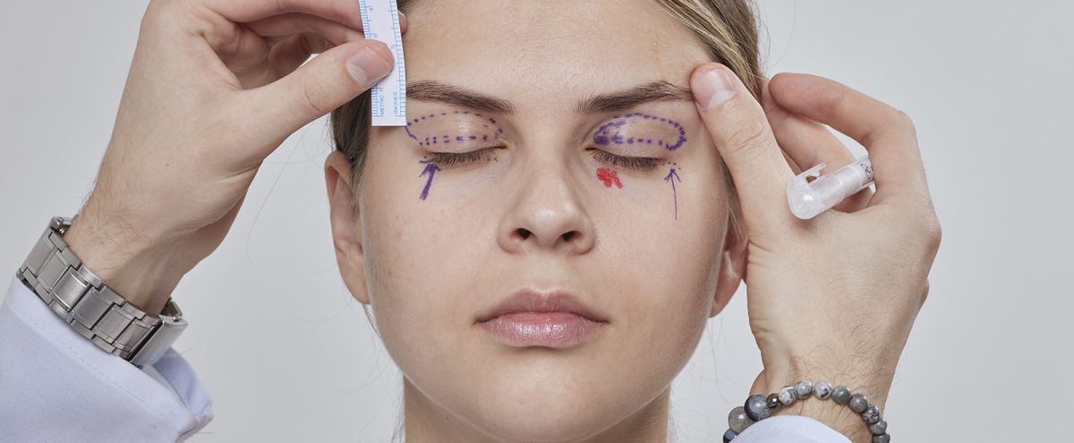 Errores en cirugías de párpados: cómo reclamar