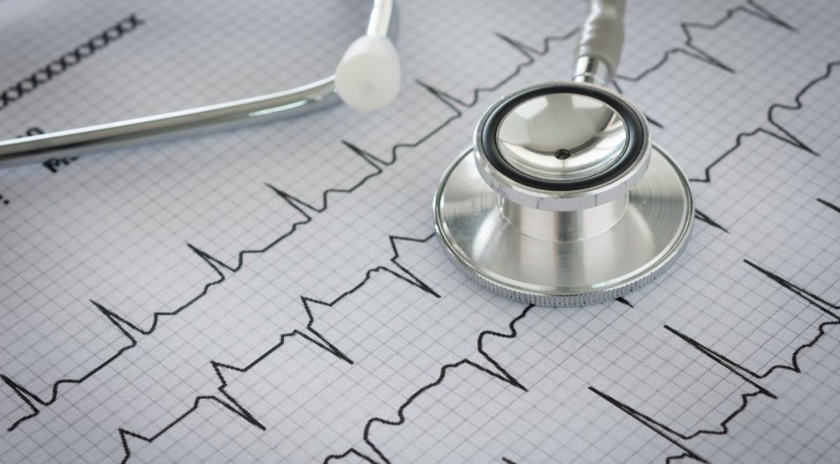 Indemnización por retraso en diagnóstico de infarto