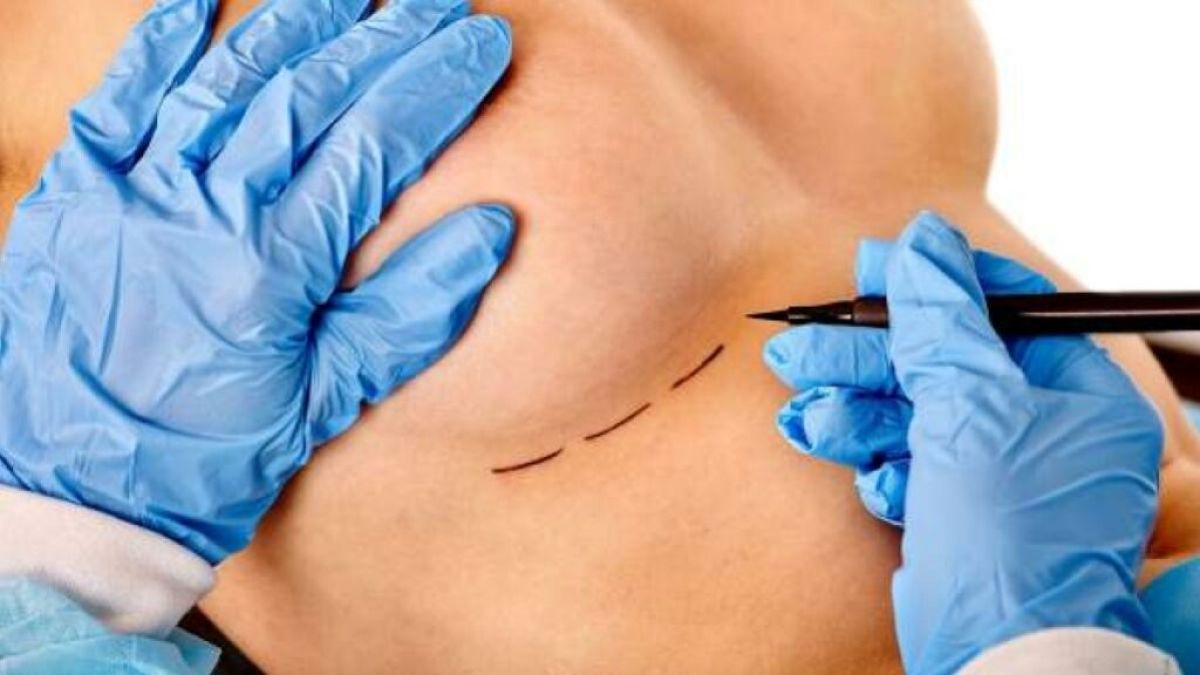 Negligencia médica en cirugía bariátrica