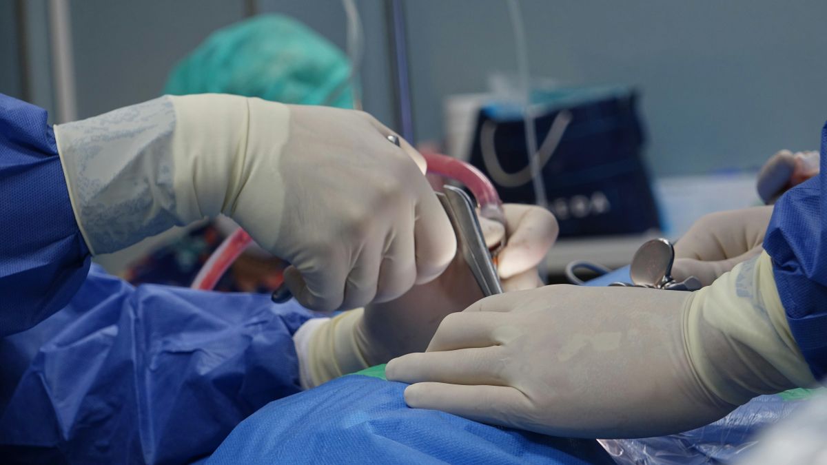 Negligencia médica en trasplante estético capilar