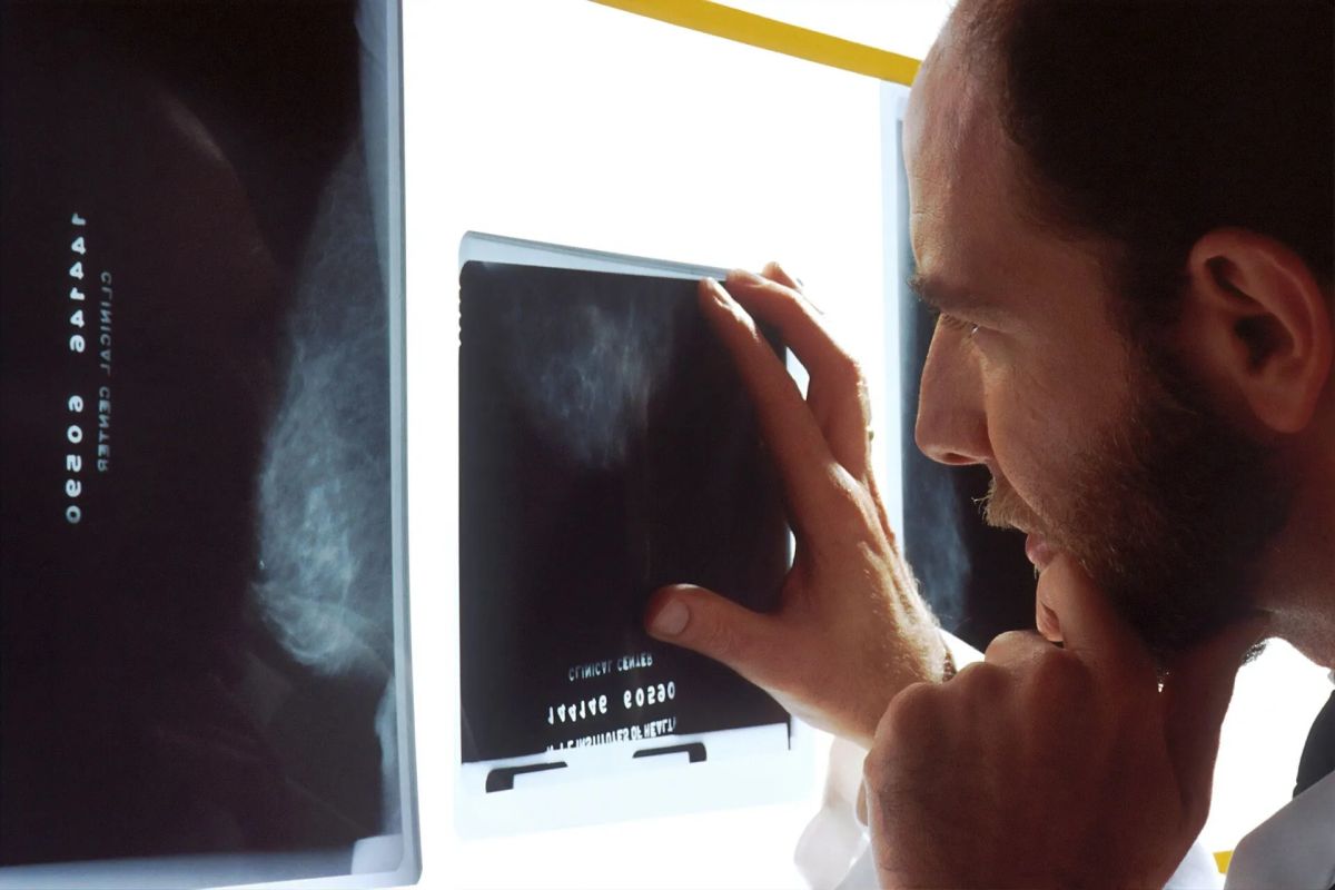 Prueba radiológica mal valorada: qué puede reclamarse