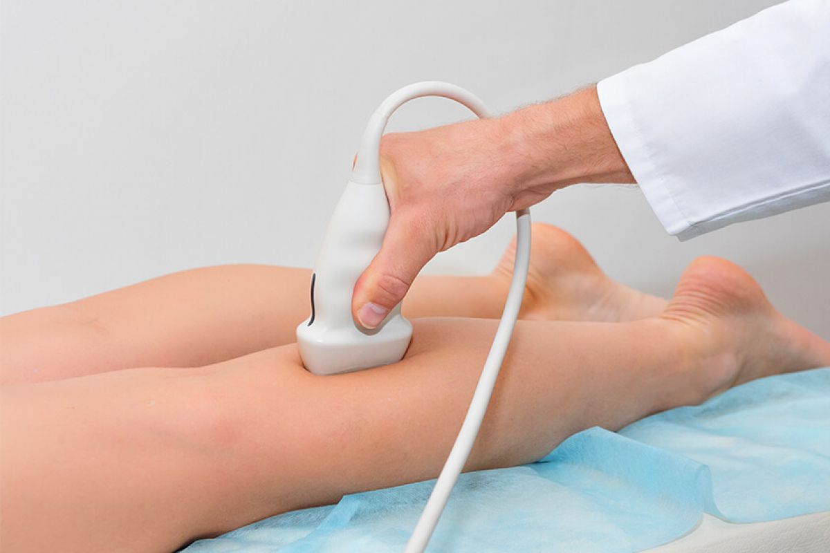 Reclamaciones por complicaciones en cirugía de varices